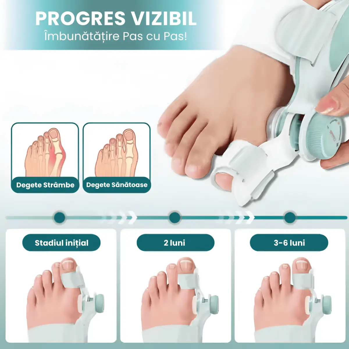 Bunion Corrector Hallux Valgus Adjustable Brace