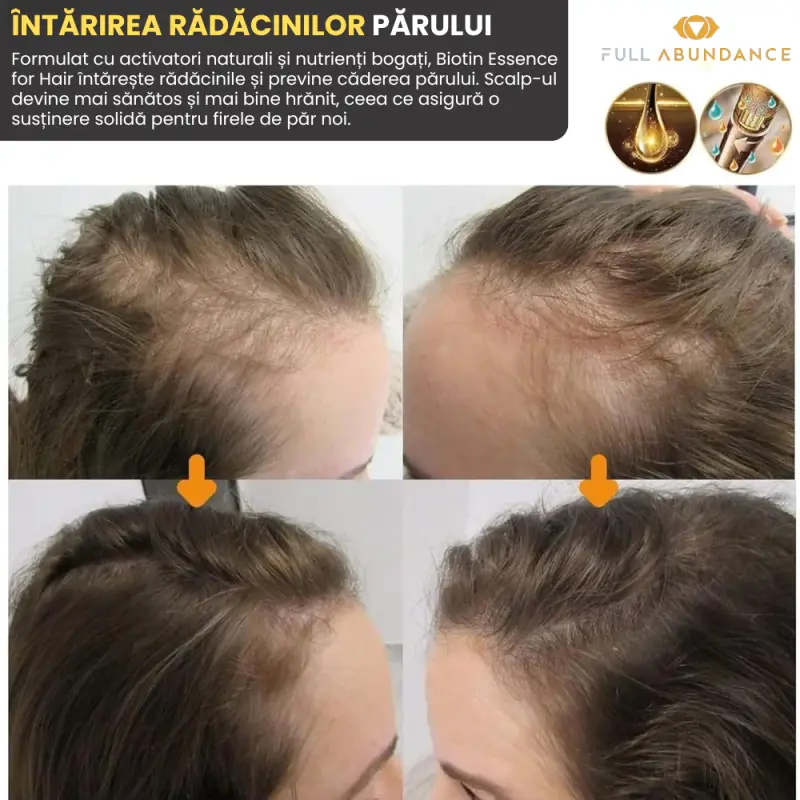 3 bucati Ser Biotin pentru Par