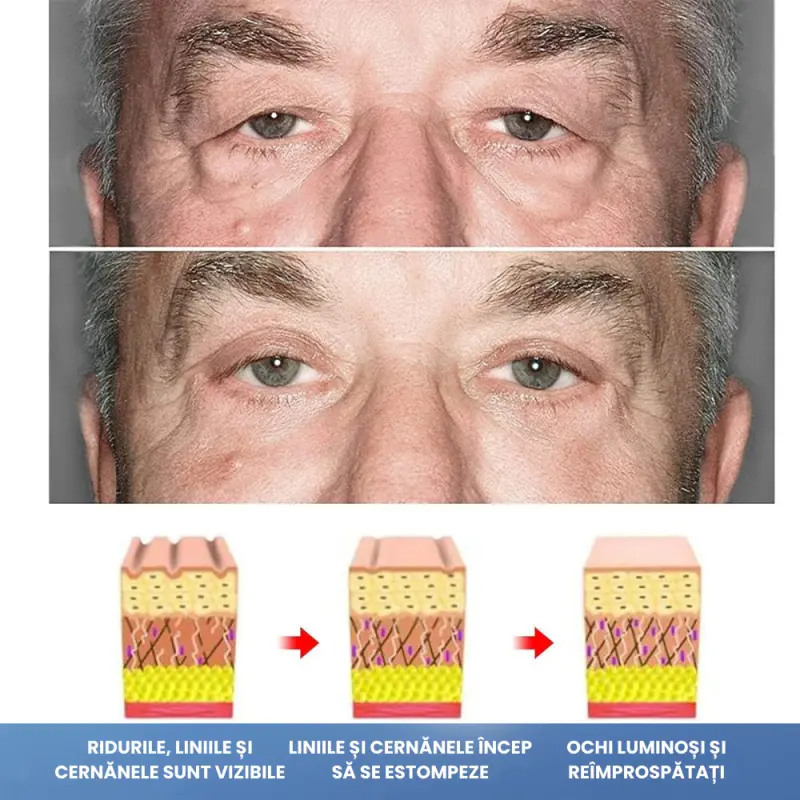 Set 4 x Tratament Contur Ochi Retinol 15ml