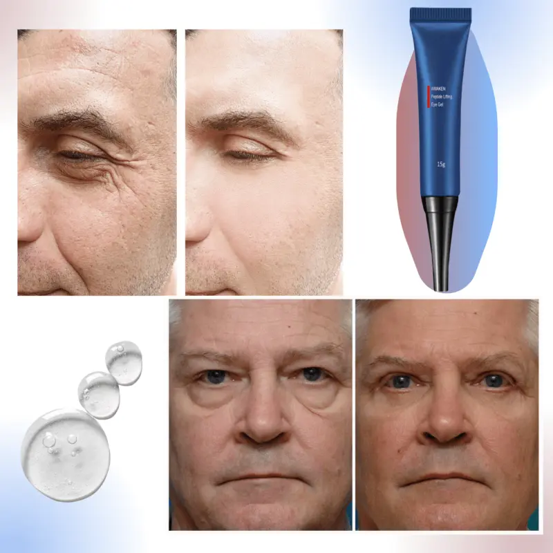 Set 4 x Tratament Contur Ochi Retinol 15ml