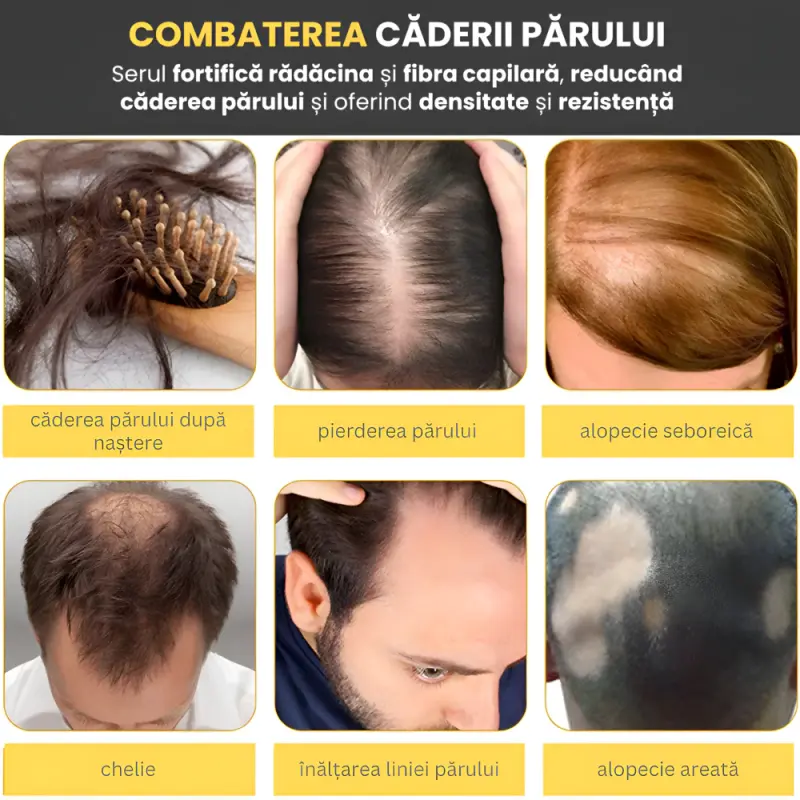 4 x Ser Biotina pentru Par