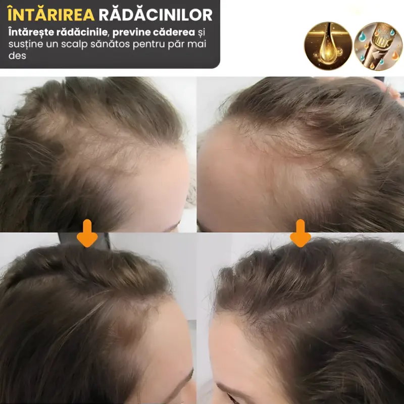 4 x Ser Biotina pentru Par