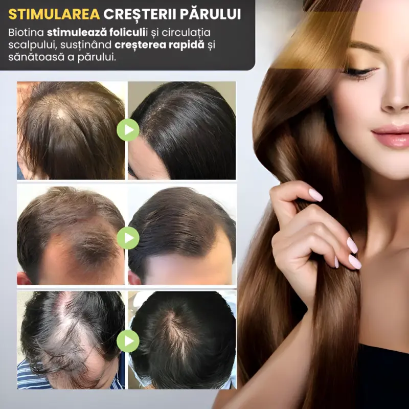 4 x Ser Biotina pentru Par