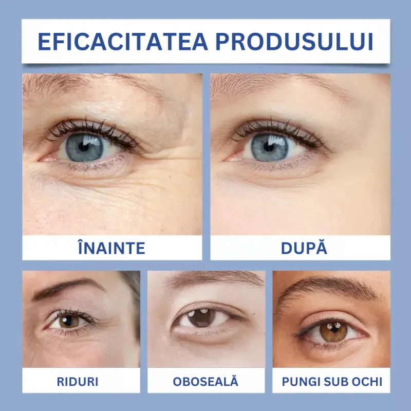 4 x Tratament Contur Ochi cu Peptide