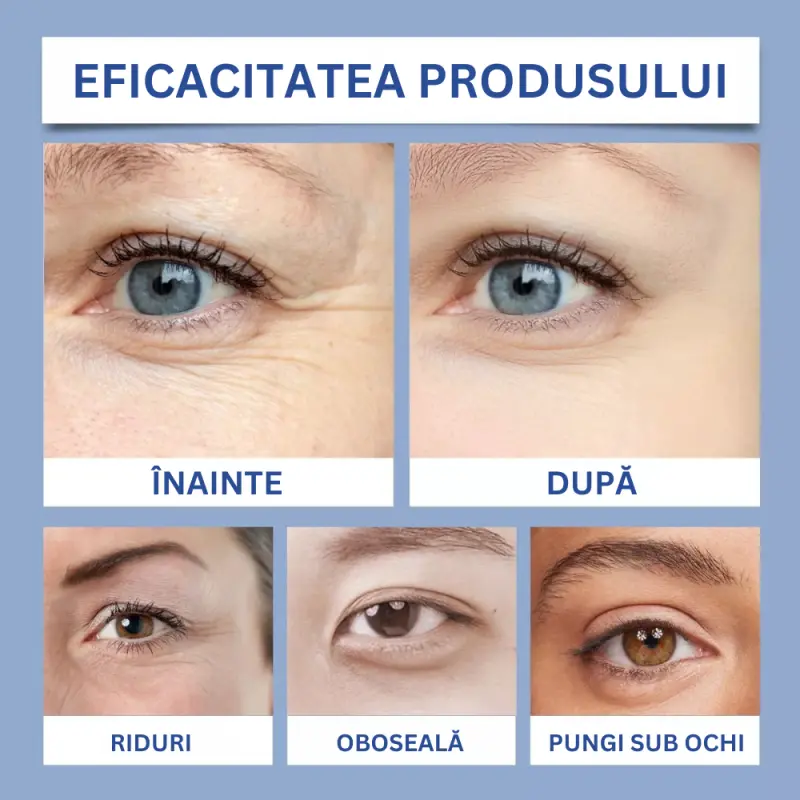 6x Tratament Contur Ochi cu Peptide