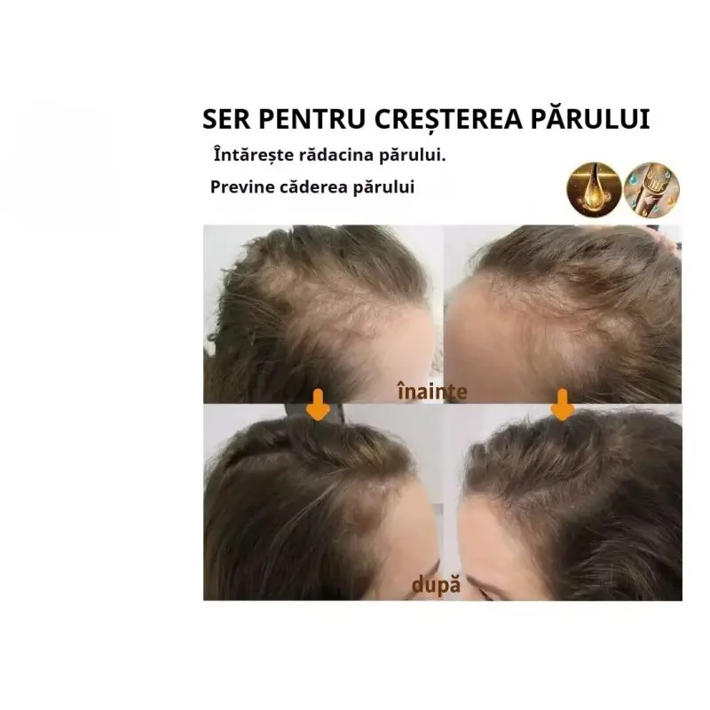 2 Spray cu Biotina pentru Regenerarea