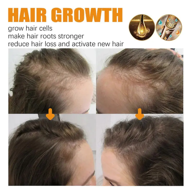 Serum de crestere a parului Biotin