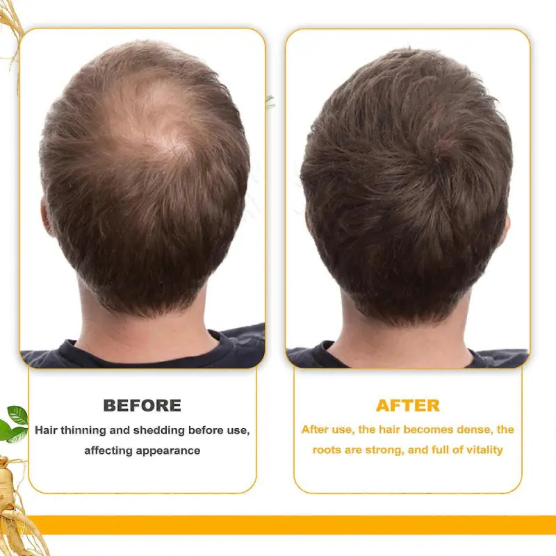 Serum de crestere a parului Biotin
