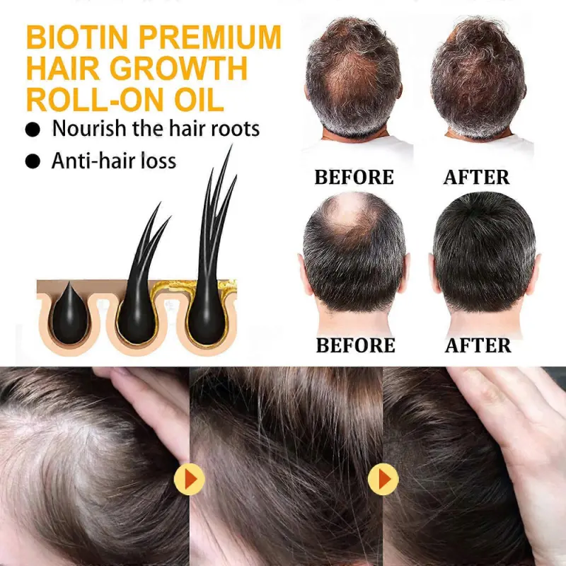 Serum de crestere a parului Biotin
